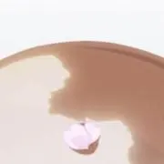 アジノヒラキの画像