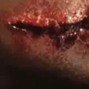 Lの画像