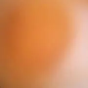 #nico