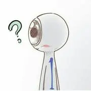 ミッキー