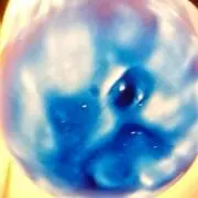 サンコブタ