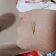 キュン