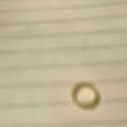 歯ゴムの画像