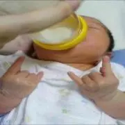 マルコメX