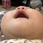 まだらの画像