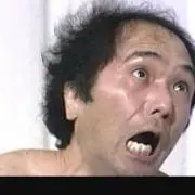 ☆私の頭はハゲ模様☆の画像