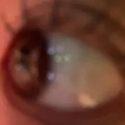 きょの画像