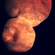 ArrokothInNeedUNeedUの画像