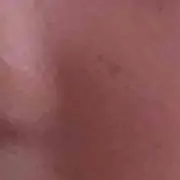 うつ病
