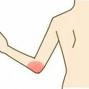 ひじの画像