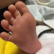 チャンの画像