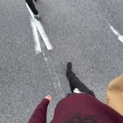 扁桃腺の画像