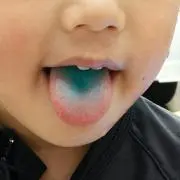 カピコ