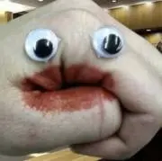 ASの画像